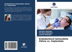 Bookcover of Endodontisch behandelte Zähne vs. Implantate