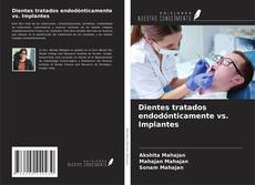 Couverture de Dientes tratados endodónticamente vs. Implantes