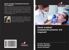 Denti trattati endodonticamente V/S impianti kitap kapağı
