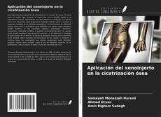Copertina di Aplicación del xenoinjerto en la cicatrización ósea