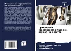 Bookcover of Применение ксенотрансплантата при заживлении костей