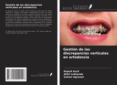 Copertina di Gestión de las discrepancias verticales en ortodoncia