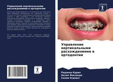 Portada del libro de Управление вертикальными расхождениями в ортодонтии