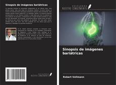 Bookcover of Sinopsis de imágenes bariátricas