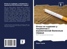Bookcover of Отказ от курения у пациентов с ишемической болезнью сердца