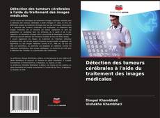 Bookcover of Détection des tumeurs cérébrales à l'aide du traitement des images médicales