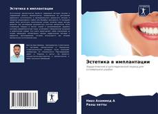 Bookcover of Эстетика в имплантации