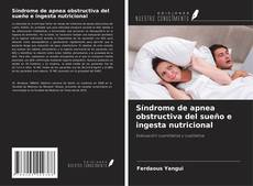 Buchcover von Síndrome de apnea obstructiva del sueño e ingesta nutricional
