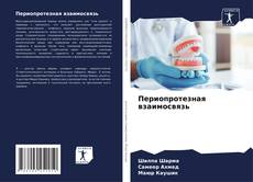 Bookcover of Периопротезная взаимосвязь