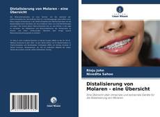 Bookcover of Distalisierung von Molaren - eine Übersicht