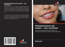Buchcover von Distalizzazione dei molari - una revisione