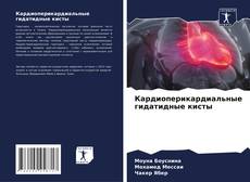 Buchcover von Кардиоперикардиальные гидатидные кисты
