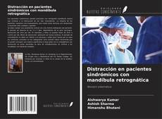 Bookcover of Distracción en pacientes sindrómicos con mandíbula retrognática