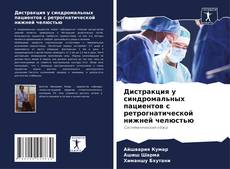 Buchcover von Дистракция у синдромальных пациентов с ретрогнатической нижней челюстью