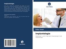 Portada del libro de Implantologie