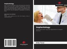 Обложка Implantology