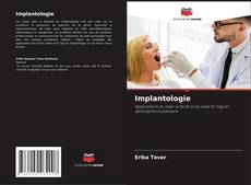 Implantologie kitap kapağı