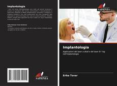 Capa do livro de Implantologia 