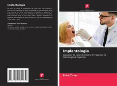 Обложка Implantologia
