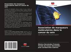 Capa do livro de Association de marqueurs moléculaires dans le cancer du sein 