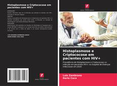 Histoplasmose e Criptococose em pacientes com HIV+ kitap kapağı