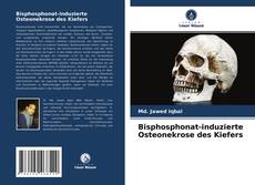 Capa do livro de Bisphosphonat-induzierte Osteonekrose des Kiefers 