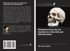 Portada del libro de Osteonecrosis de los maxilares inducida por bifosfonatos