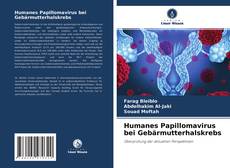 Capa do livro de Humanes Papillomavirus bei Gebärmutterhalskrebs 