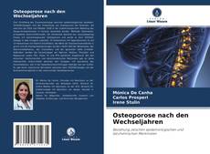 Osteoporose nach den Wechseljahren的封面