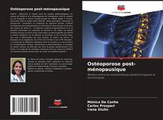 Обложка Ostéoporose post-ménopausique