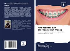 Buchcover von Минивинты для втягивания En-masse