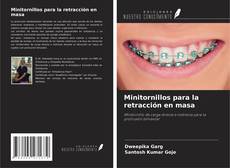 Bookcover of Minitornillos para la retracción en masa