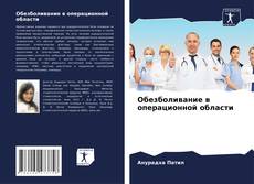 Buchcover von Обезболивание в операционной области
