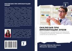 Buchcover von ОККЛЮЗИЯ ПРИ ИМПЛАНТАЦИИ ЗУБОВ