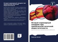 Portada del libro de Острый коронарный синдром при хронической почечной недостаточности