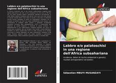 Bookcover of Labbro e/o palatoschisi in una regione dell'Africa subsahariana