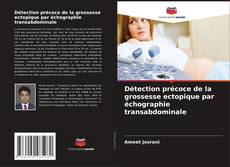 Bookcover of Détection précoce de la grossesse ectopique par échographie transabdominale