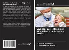Bookcover of Avances recientes en el diagnóstico de la caries dental