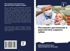 Последние достижения в диагностике кариеса зубов的封面