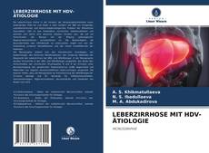 LEBERZIRRHOSE MIT HDV-ÄTIOLOGIE kitap kapağı
