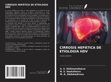 Bookcover of CIRROSIS HEPÁTICA DE ETIOLOGÍA HDV