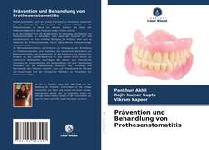 Prävention und Behandlung von Prothesenstomatitis kitap kapağı