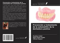 Couverture de Prevención y tratamiento de la estomatitis de la dentadura postiza