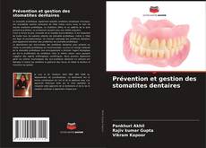 Bookcover of Prévention et gestion des stomatites dentaires