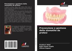 Capa do livro de Prevenzione e gestione della stomatite da protesi 
