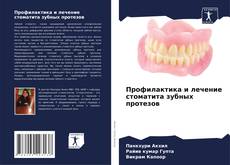 Профилактика и лечение стоматита зубных протезов kitap kapağı