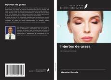 Buchcover von Injertos de grasa