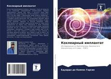 Bookcover of Кохлеарный имплантат