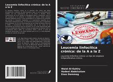 Bookcover of Leucemia linfocítica crónica: de la A a la Z