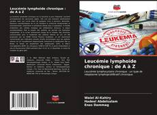 Capa do livro de Leucémie lymphoïde chronique : de A à Z 